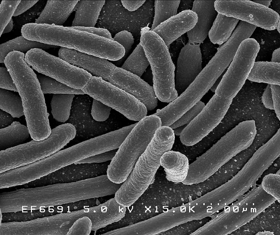 ELISA  Recombinant Escherichia coli Uncharacterized protein yhjU(yhjU)