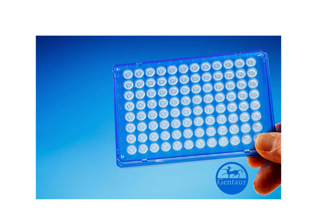 ELISA   ?-hydroxybutyryl-HIST1H3A (K9) anti-